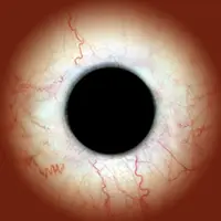 Sclera image